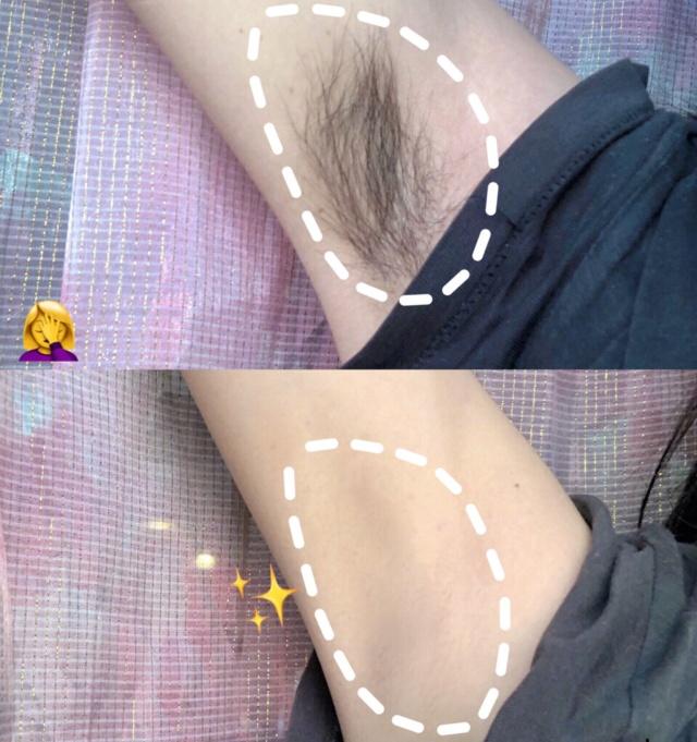 女人这4个部位越丑越健康,女生两腮的毛会不会越刮越多