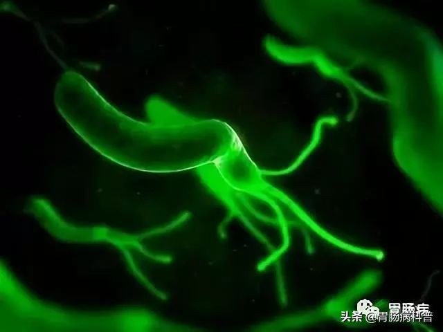 幽门螺杆菌为什么不建议根除,幽门螺杆菌根本治不好