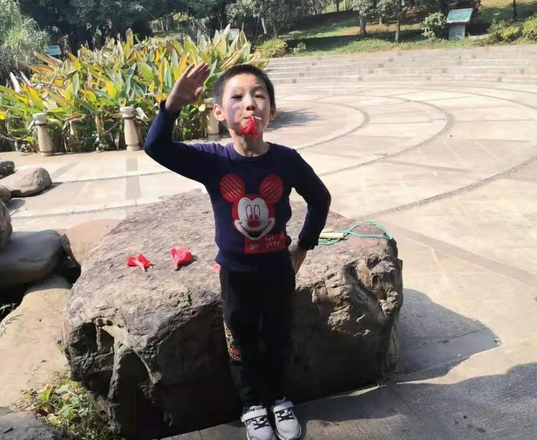 孩子吃糖牙疼怎么治,孩子吃糖牙疼怎么快速缓解