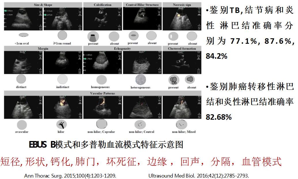 孙加源门诊,治疗肺癌的新技术新手段