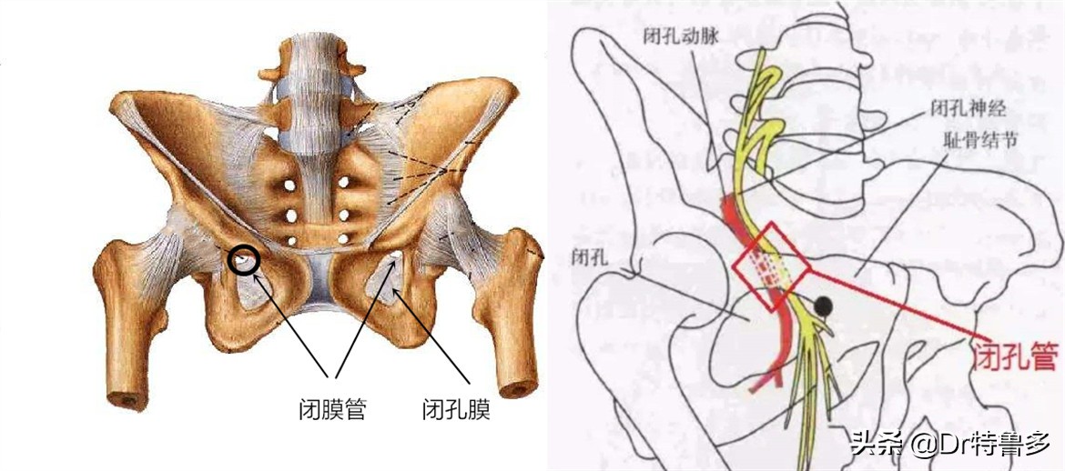 大腿内侧痛，胯也痛...有根神经被卡住了