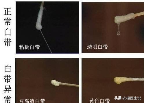 女性同志要长点心，阴道分泌物呈这6种颜色，就不能再同房了！