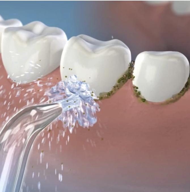 电动牙刷推荐欧乐比飞利浦,有牙刷还要买冲牙器吗