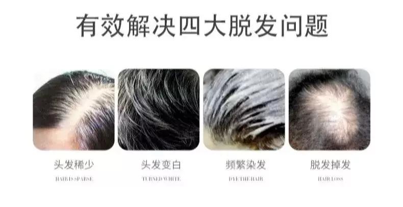 日系短发假发推荐,适合大圆脸的日常假发