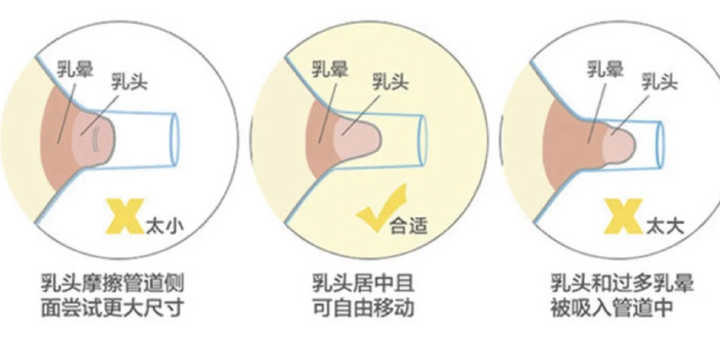 有没有必要买贵的吸奶器,便宜的吸奶器和贵的有什么区别