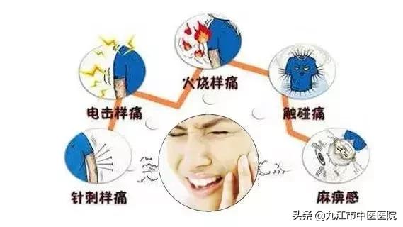 十年治愈面肌痉挛和三叉神经痛患者千例！九江市中医医院专注颅神经疾病治疗