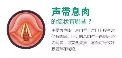 什么情况下有息肉会癌变,哪些部位长息肉最严重