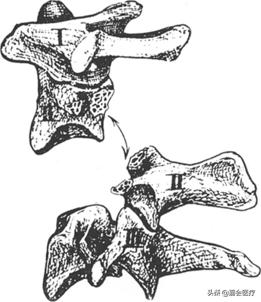 她被判处绞刑，吊了半小时却没死，这个医生说出了真相