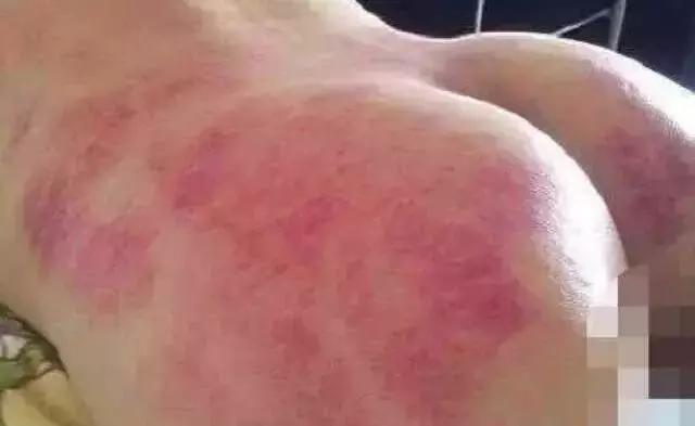 臀部两侧陷窝,臀部臀窝怎么练