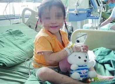 孩子玩干燥剂眼睛被溶解,孩子玩荧光棒水进眼睛