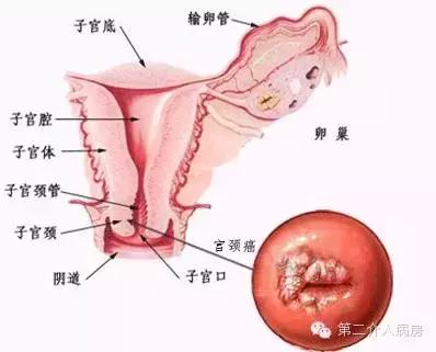恶性肿瘤介入治疗是什么意思,良恶性肿瘤的介入治疗ppt