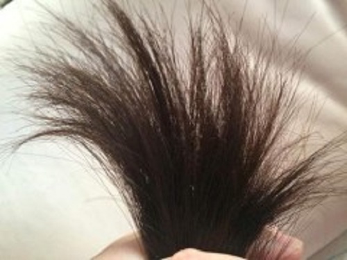 头发分叉,你的解决办法是什么?