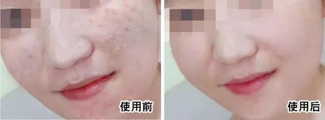 38岁全智贤不愧是国民女神 (年轻时的全智贤满满的胶原蛋白)