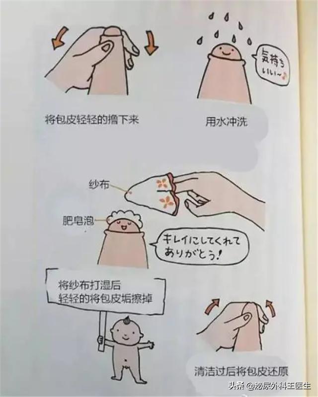 男性阴茎癌病前征兆,阴茎癌青年发病率