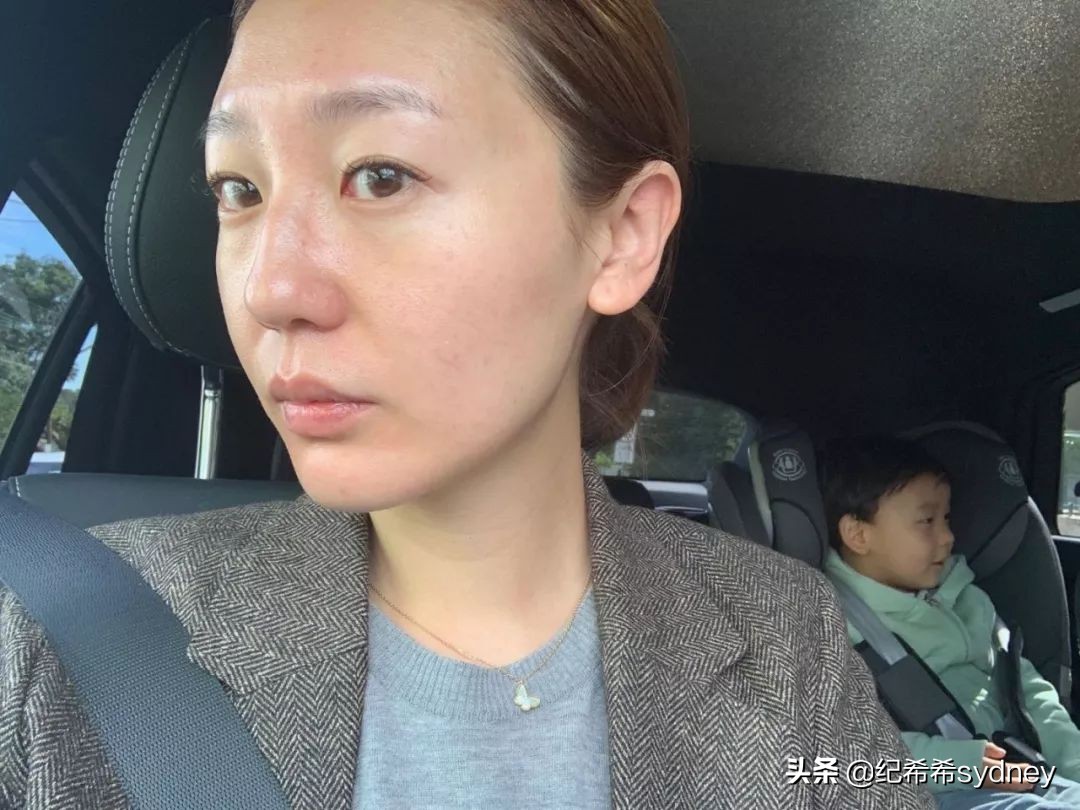 皮秒真实测评,皮秒收缩毛孔测评