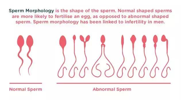 一颗精子和卵子结合概率,一颗精子和卵子相遇过程