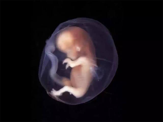 孩子头顶两个旋代表什么,头顶旋多的孩子有什么意思