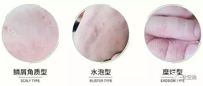 对于脚臭的人，敢脱鞋相见的是真朋友！鞋袜除味喷雾让你自信脱鞋