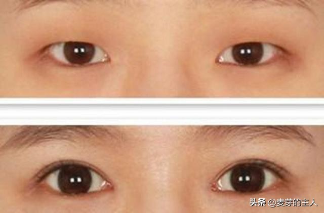 眼睛小的女生怎么改善,女生眼睛小怎么修