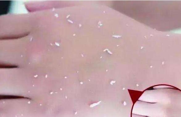 护肤品一上脸就“搓泥”？脸上都是“泥屑屑”怎么办？