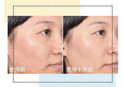 olay和欧莱雅哪个好性价比高,欧莱雅和olay哪个高档一点