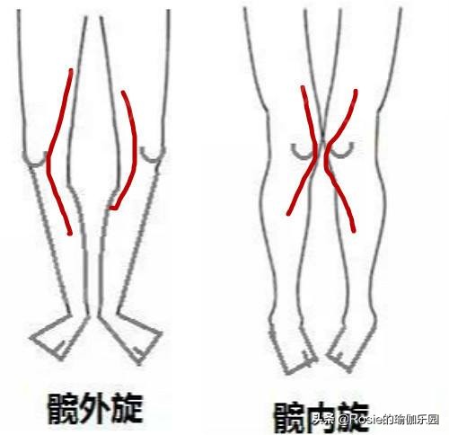 假胯宽怎么消除最有效,假胯宽是什么原因怎么治