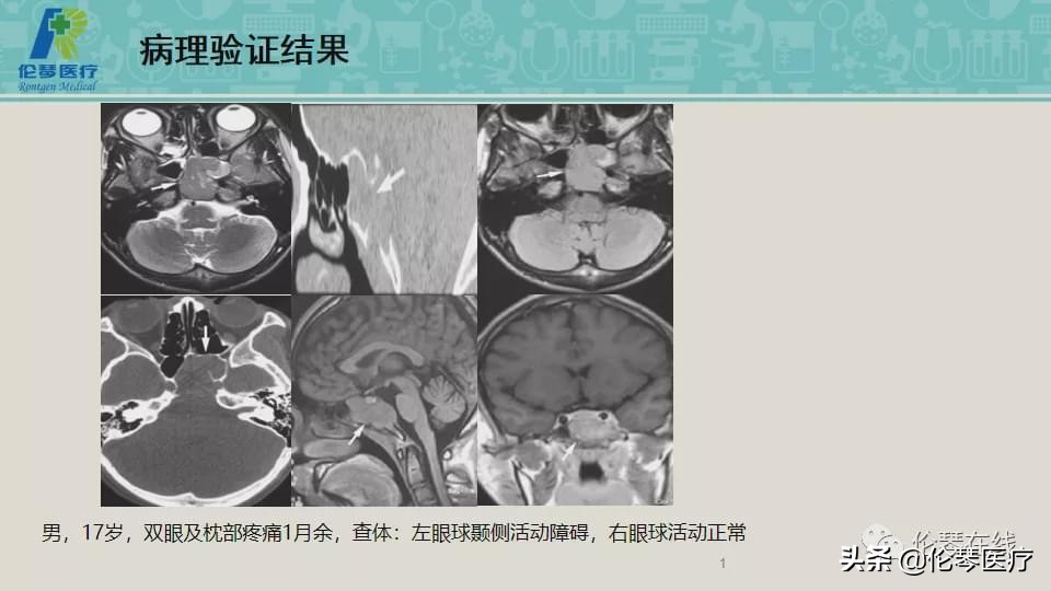 上海教授詹松华,上海曙光医院詹松华简介