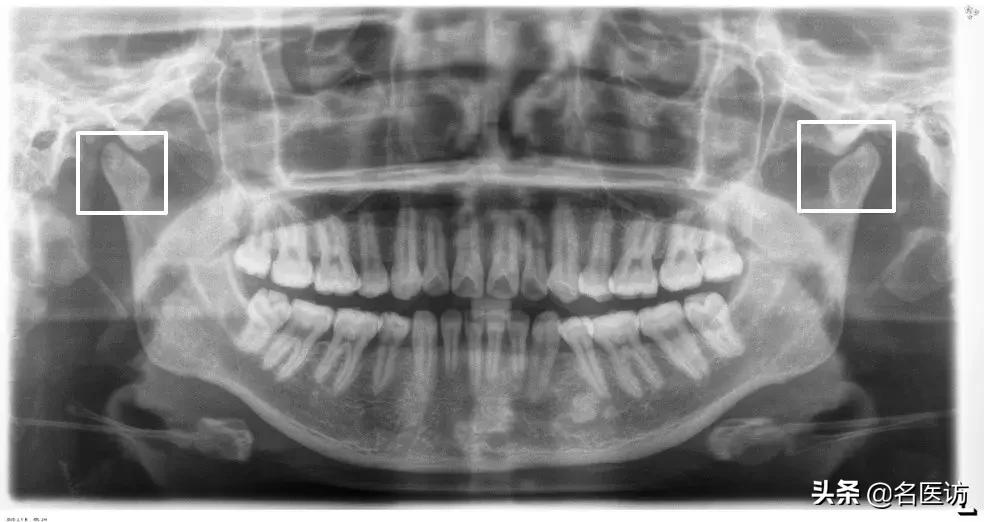 矫正牙科普馆,矫正牙齿科普知识