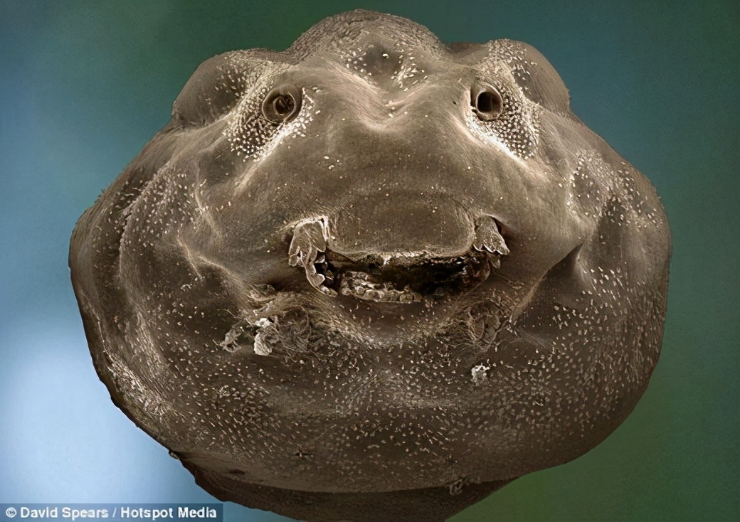 用曼陀罗种子治青春痘,偏方曼陀罗