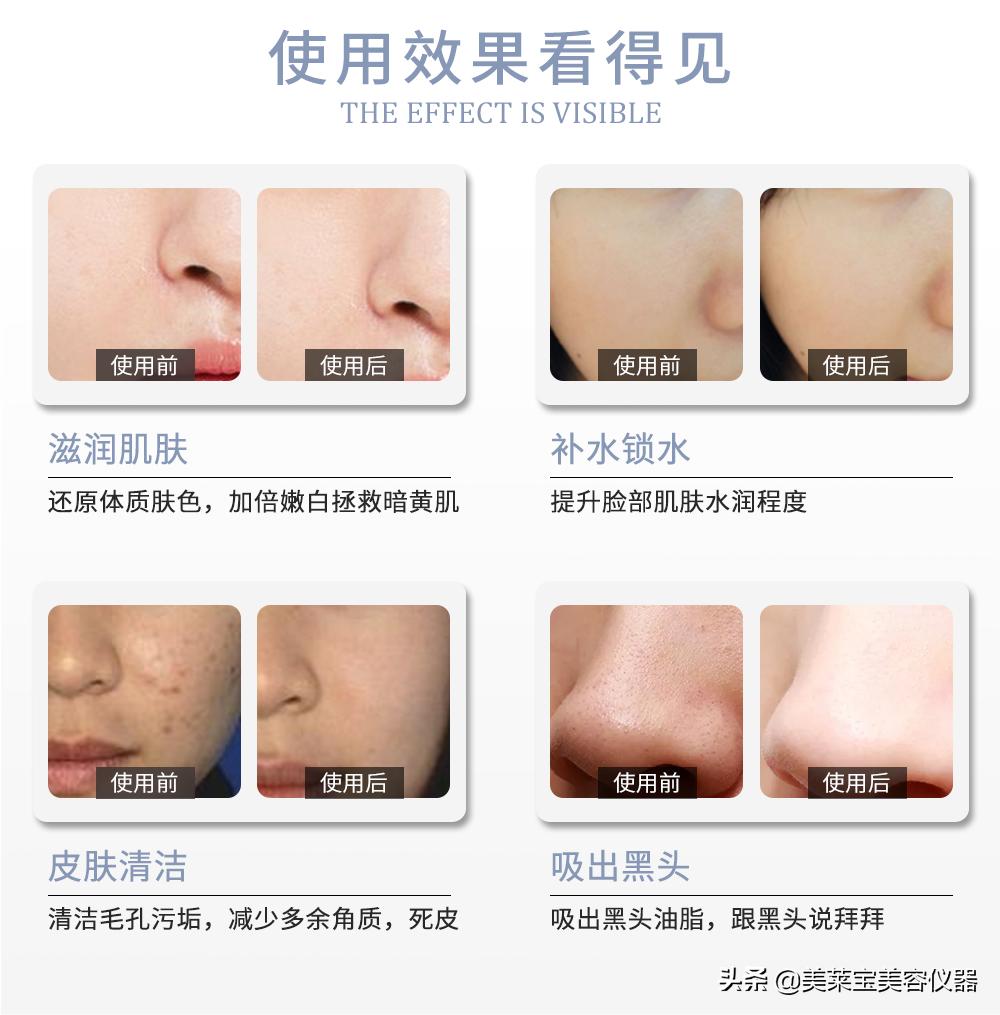 美肤小气泡效果怎么样,美肤超微小气泡