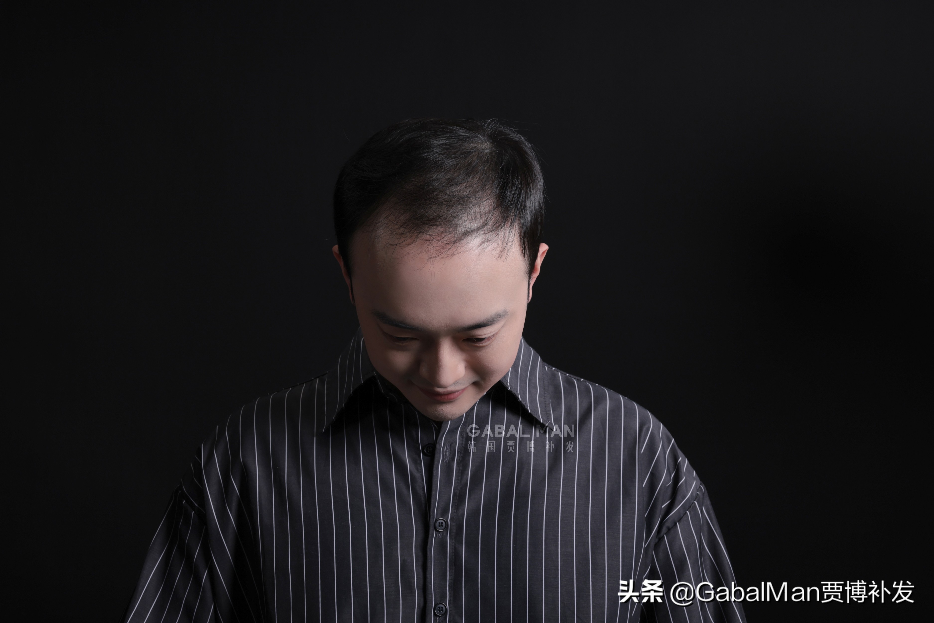 秃头后剃光头戴假发怎么样,如果秃头了买什么假发好