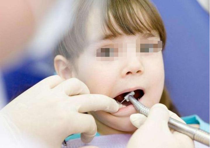 3岁儿童龋齿怎么办,3周小孩龋齿吃什么预防