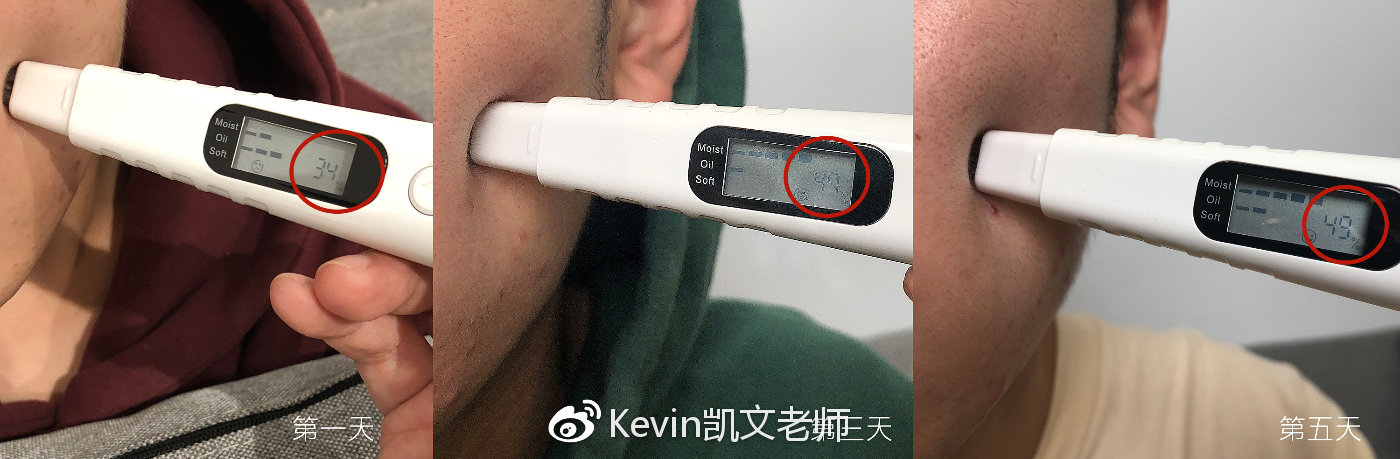 鏁忔劅鑲岀鐥樹竴濂楁姢鑲ゅ搧鎺ㄨ崘 (鏁忔劅鑲岀鐥樻姢鑲ゅ搧)