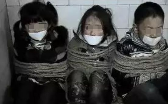 眼球被挖走了还能恢复吗,眼球被挖了还会活着吗