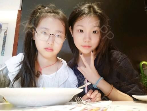 一次脸部微整形换来五年修复路,面部微整形美容前后对比