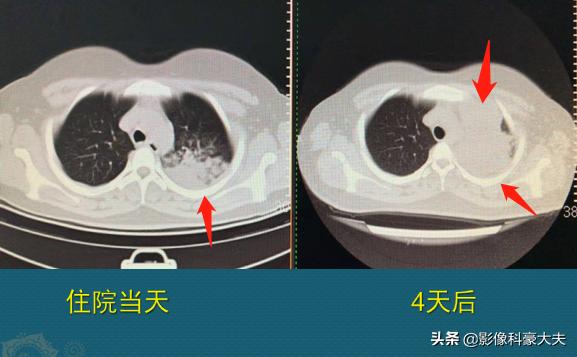 陪理科高材生的女同学看病，真麻烦，豪大夫想拉黑她