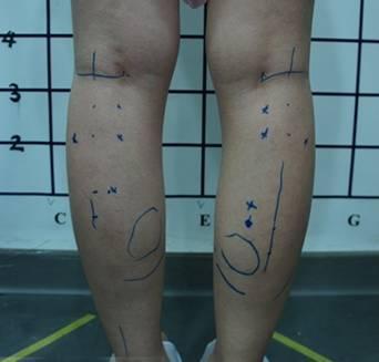 萝卜腿怎么改善肌肉腿,萝卜腿怎么三天快速瘦成筷子腿