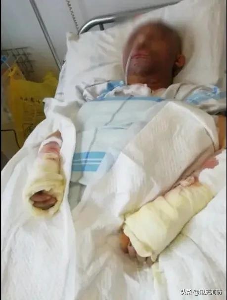 男子一边充电一边玩手机突然爆炸,男子边充电边玩手机发生爆炸