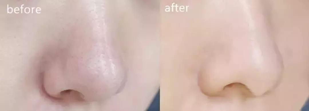 大创美白精华和雪肌精哪个好,大创美白精华