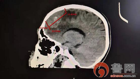 仁心济世救重患村医感恩送锦旗,医生妙手回春患者感激送锦旗