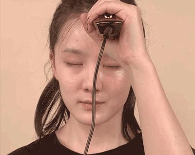 微整的真实效果,微整蜕变过程