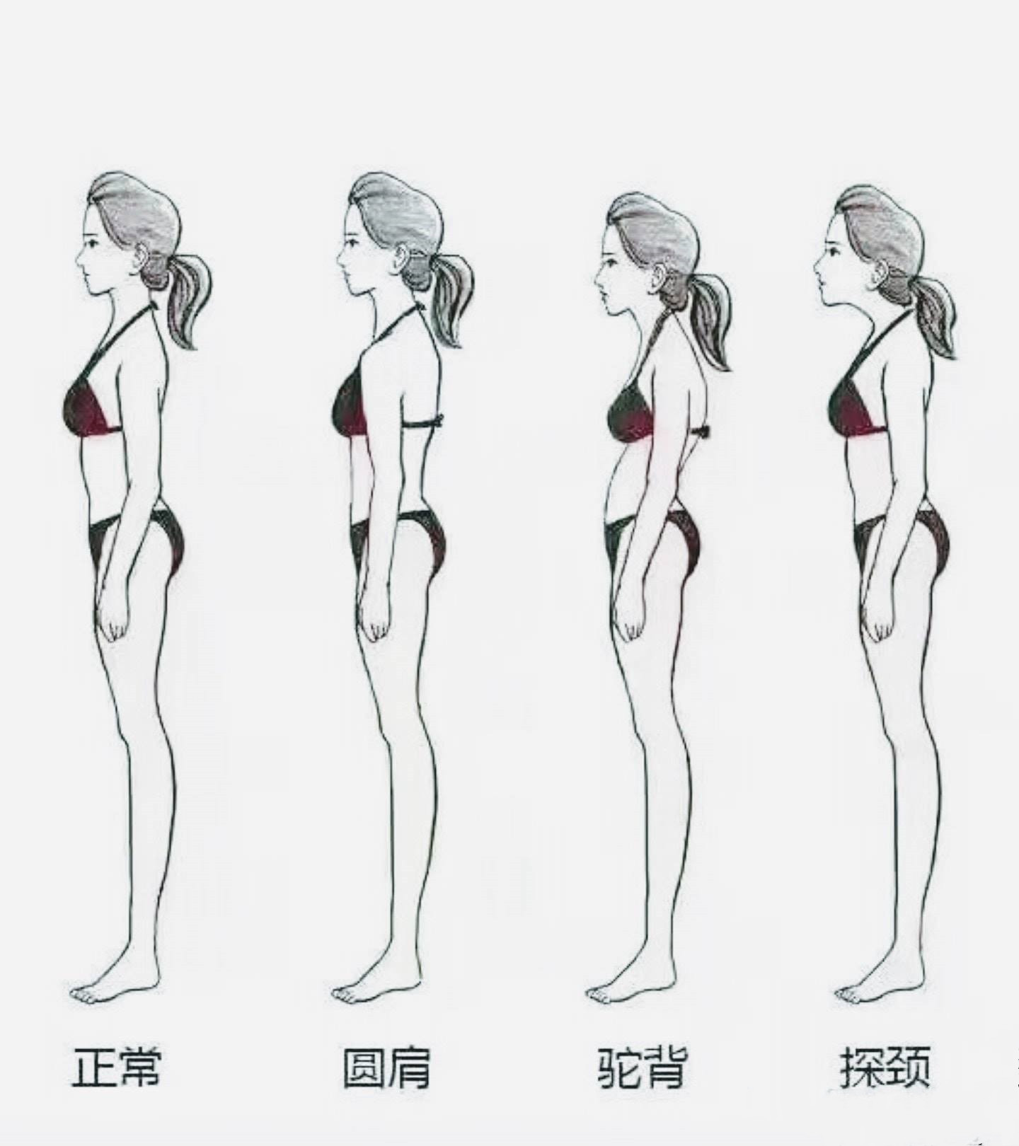 圆肩带来的影响,圆肩和正常肩的区别图片