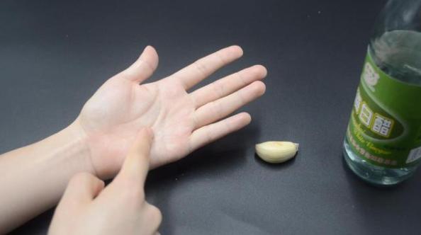 白醋搓手心能治疗什么病,白醋倒在手心搓一搓是什么意思