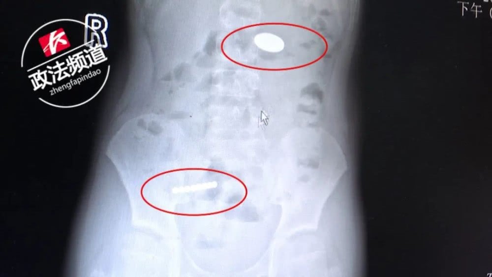 磁力珠玩具,磁力珠千万别给孩子玩了