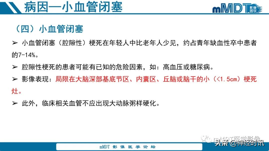 急性缺血性脑卒中ppt素材图片,青年缺血性脑卒中ppt