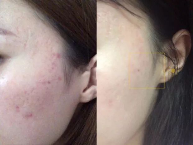 淘宝上的医美面膜是正品吗,可复美医美面膜怎么查真伪