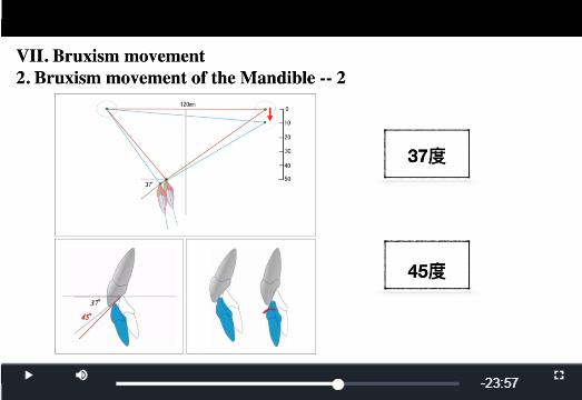 「第58期」基于磨牙检查垫的咬合诊断
