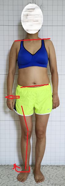 产后弹响髋,产后髋关节不对称的原因