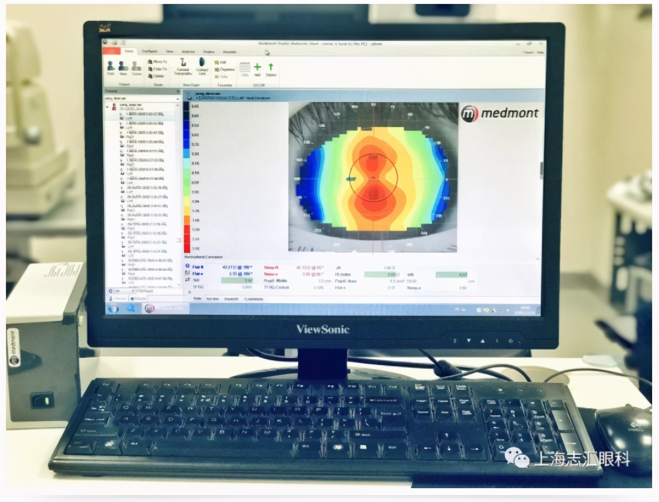 ok镜复查眼轴要停戴吗,ok镜复查需要做哪些项目