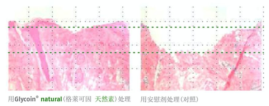 赵露思推荐补水保湿,赵露思推荐水感保湿焕颜面霜